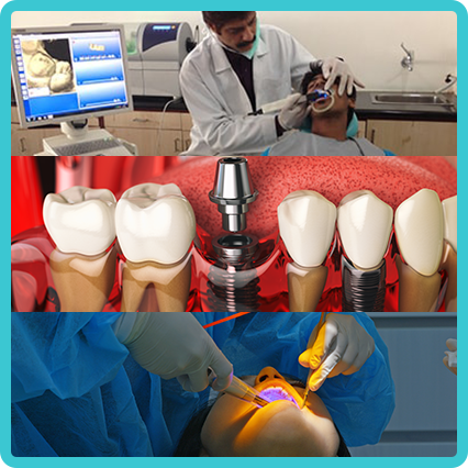 Dental Clinic Hyderabad